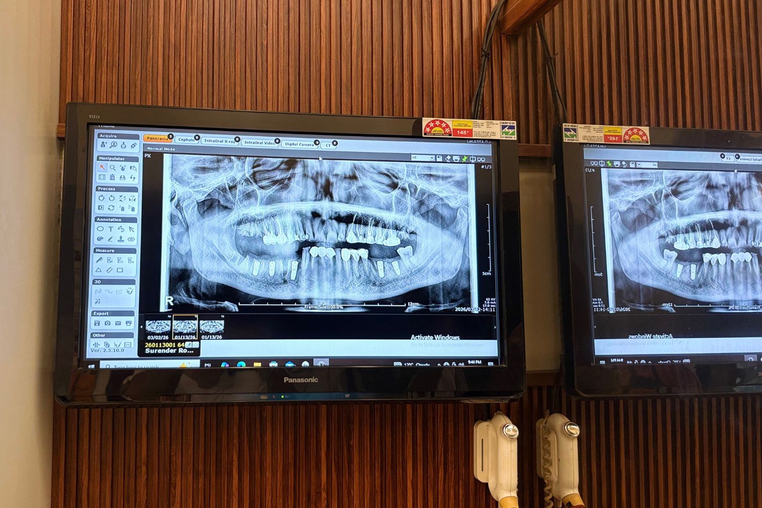 All smile Dental (gallery) (2)